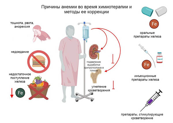 Химиотерапия при онкологических заболеваниях